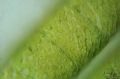 Spirogyra sp.